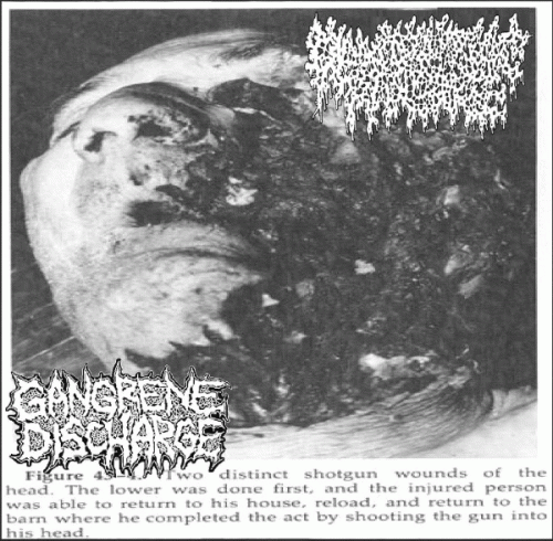 Gangrene Discharge : Pancreatic Pancake - Gangrene Discharge